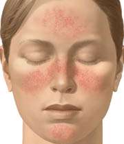 لكه های تیره روی پوست