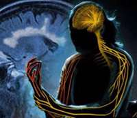 علت بیماری ام اس