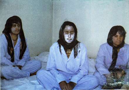 شهدای شیمیایی و آسیب های ناشی از بمب شیمیایی