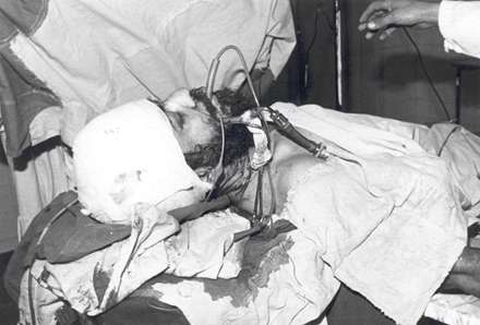 تصوير شهيد محمد مفتح در اتاق عمل