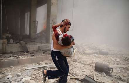 کودک مجروح شده بر اثر انفجار خودروی بمب گذاری شده در حومه دمشق