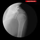 حرکت استخوان زیر اشعه ایکس