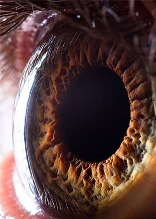 تصاویری عجیب از چشم انسان