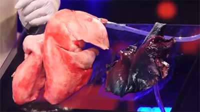 وضعیت ریه سالم 24 ساعت بعد از مصرف سیگار