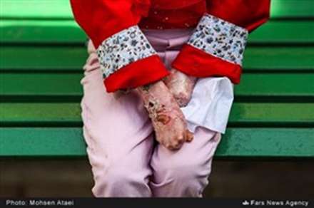 بازدید از خانه «ای‌بی»
