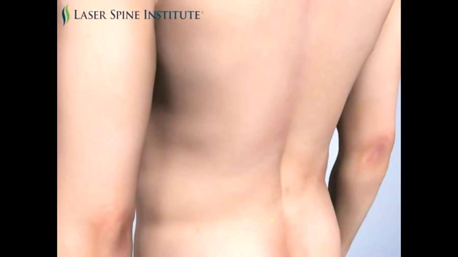 لیزر درمانی