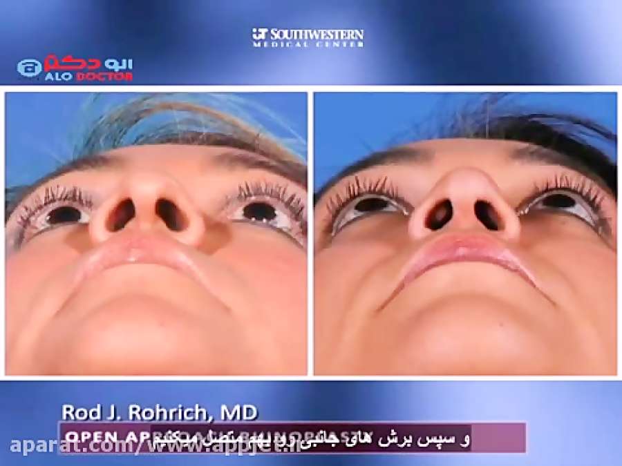 روایت جراحی بینی از نگاه دکتر محسن فدایی