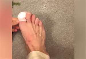 مصدومیت و نابودی کفش کارواخال مقابل انگلیس