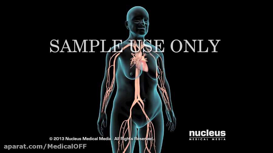 انیمشین فشار خون