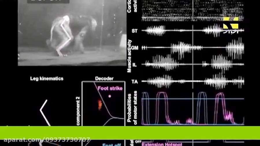 درمان جدید برای آسیب های نخاعی