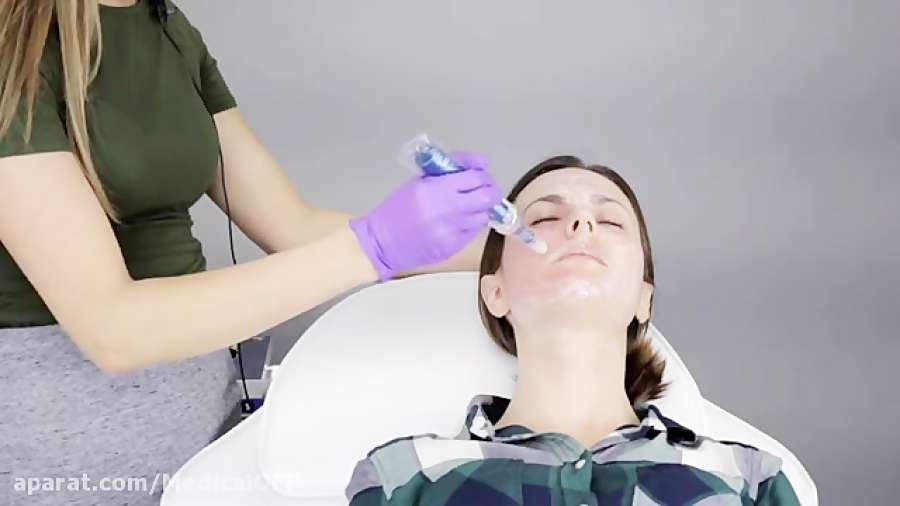 میکرونیدلینگ صورت