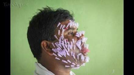 مردی با صد ها سوزن در صورت