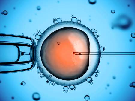 artificial insemination