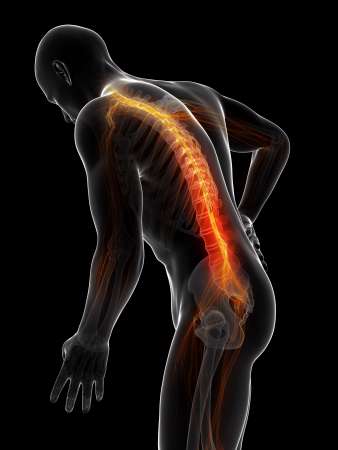 3d rendered illustration - backache male