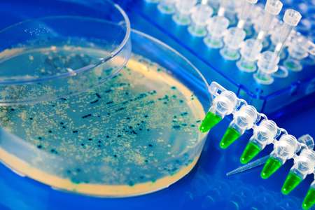 a Petri Dish with growing Virus and bacteria cells. microorganis