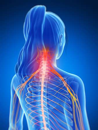 3d rendered illustration of a painful neck