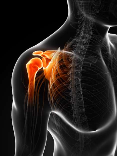 3d rendered illustration of a painful shoulder
