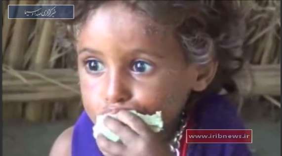 حکایت تلخ یمن و گرسنگی ...