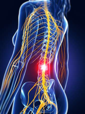 3d rendered medical illustration - backache