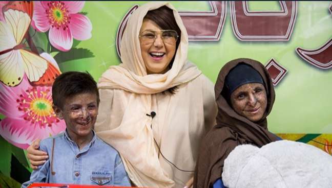 حمایت «بهنوش بختیاری» از کودکان مبتلا به سرطان پوست