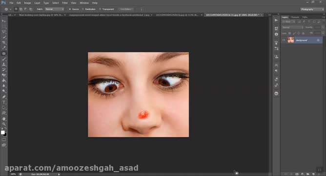 آموزش برداشتن جوش از صورت با فتوشاپ