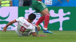 تکل شجاعانه امید ابراهیمی و مصدومیت جزئی