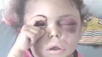 موشن گرافیک ده دقیقه در یمن