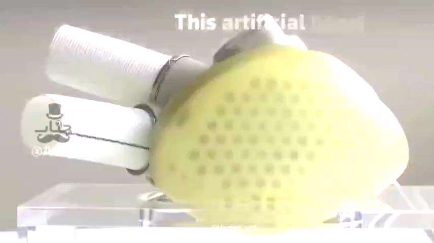 اولین قلب کاملا مصنوعی در اروپا مجوزفروش گرفت