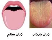 بیماری زبان باردار