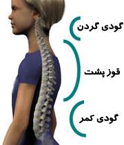 مشکلات استخوانی در کودکان