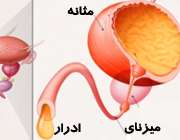 مثانه