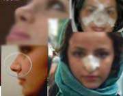 جراحی پلاستیک-عمل زیبایی