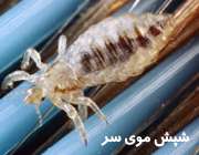 شپش موی سر