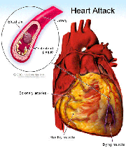 دل کے امراض