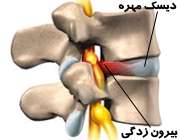 دیسک مهره ها
