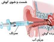 اندام بینایی و شنوایی