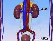 عفونت ادراری