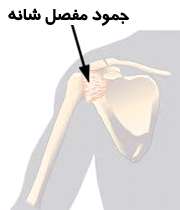 جمود مفصل شانه