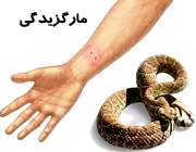 مارگزیدگی