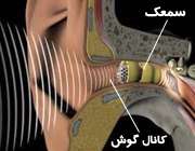 سمعک داخل گوش