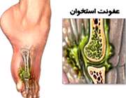 عفونت در هر جایی از بدن خطرناک است عفونت در هر جایی از بدن خطرناک است