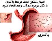 اسهال