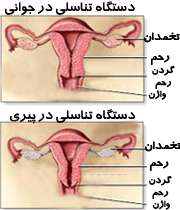 دستگاه تناسلی خانم ها