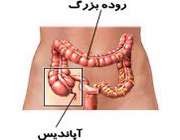 آپاندیسیت