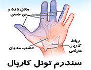 تونل کارپال