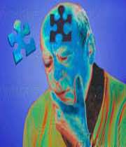آلزایمر
