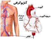 آنژیوگرافی قلب