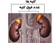 غدد فوقکلیه