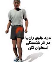 ورزش شکستگی لگن