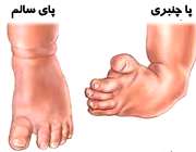 پای کودک